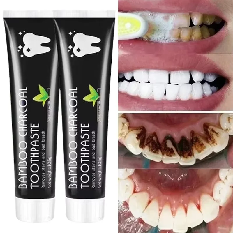Teeth Whitening Charcoal - Pasta Dental Blanqueadora con Carbón de