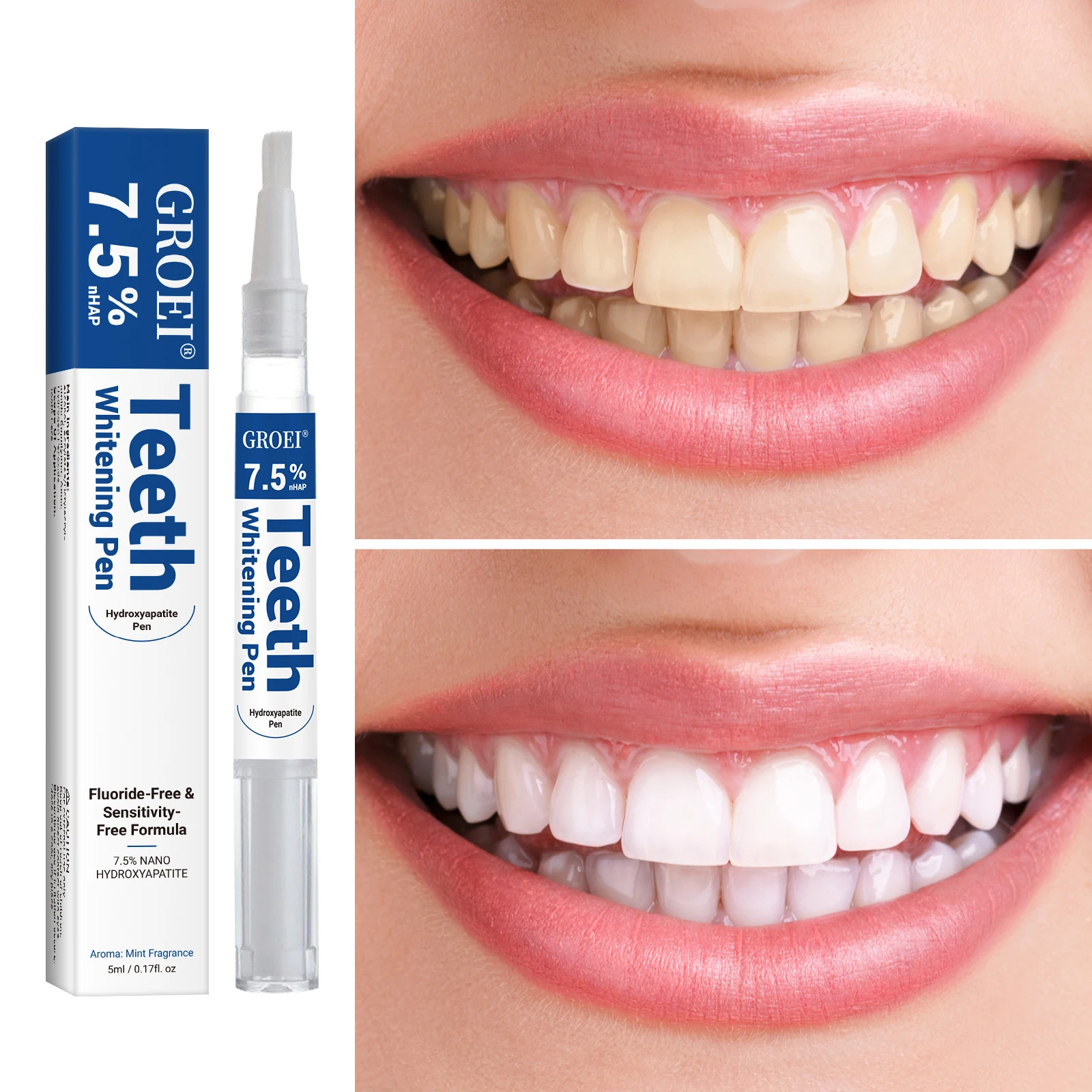 Pluma blanqueadora de dientes  - Teeth Whitening Q&M reseña y precio