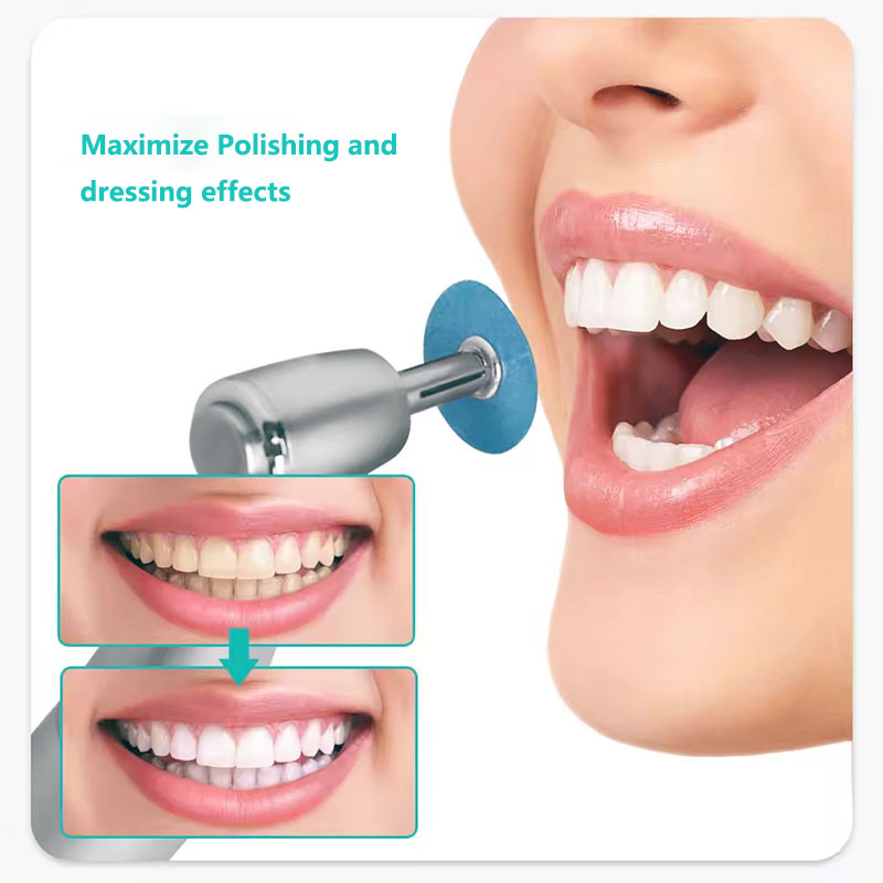 40 Uds. Discos de Pulido Denta - Teeth Whitening Express reseña y precio