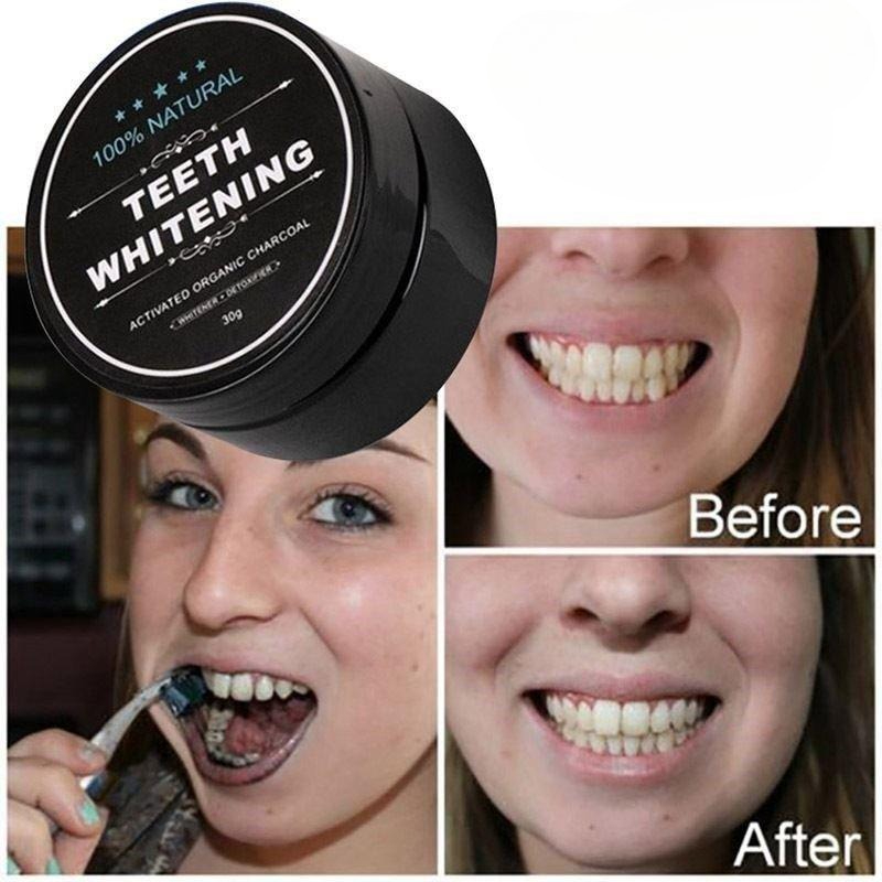 1 caja de polvo blanqueador de - Teeth Whitening Ulta reseña y precio