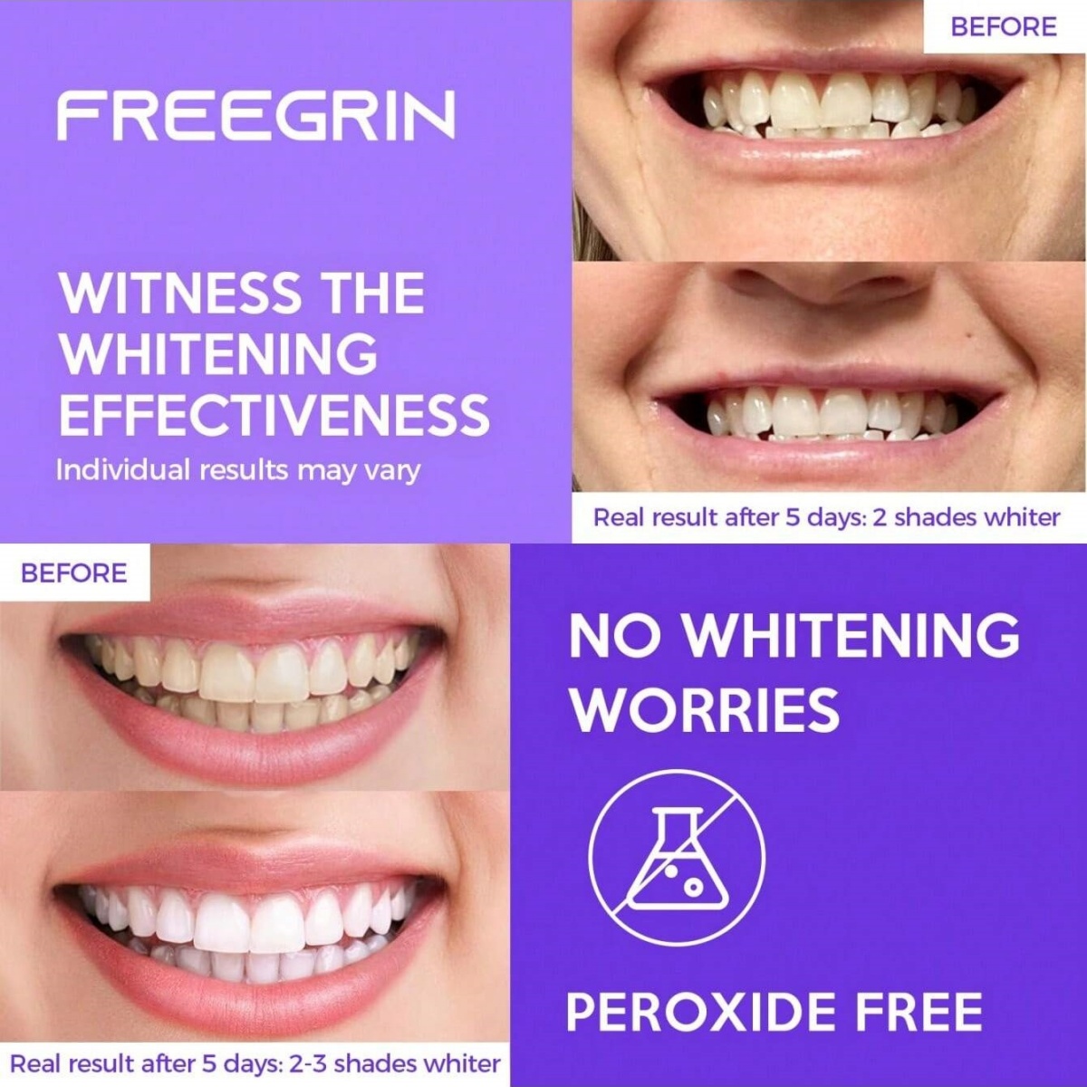 Pegatinas blanqueadoras de die - Teeth Whitening Q&M reseña y precio
